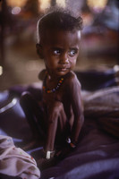Eastern Sudan: Famine victim at Wad Shirife refugee camp. - © John Francis Ficara.<br> All Rights Reserved.